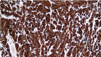 S100A1 Antibody