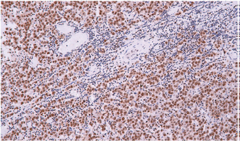SMARCA4 Antibody