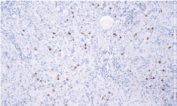 SST Antibody