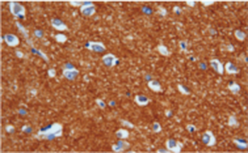 SYP Antibody