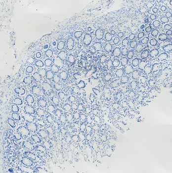 TFE3 Antibody