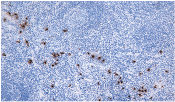 TPSAB1 Antibody