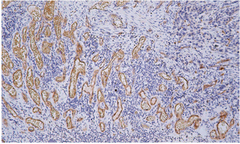 KDR Antibody
