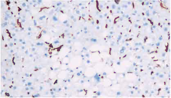 VIM Antibody