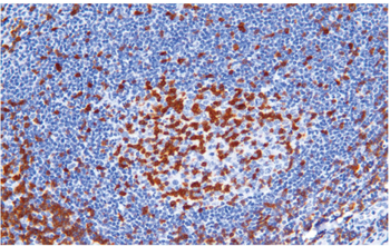 ZAP70 Antibody
