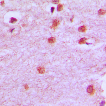 Anti-HOXA11/D11 Antibody