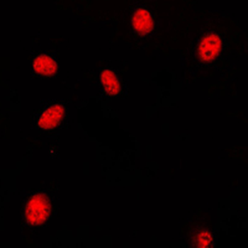Anti-HOXA11/D11 Antibody