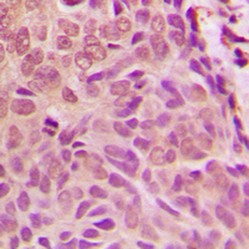 Anti-SMAD1 Antibody
