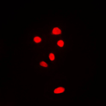 Anti-RPL11 Antibody