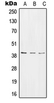 Anti-RPC Antibody