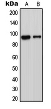ADAM23 Antibody