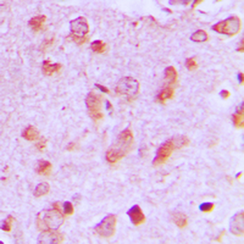Anti-JIP2 Antibody