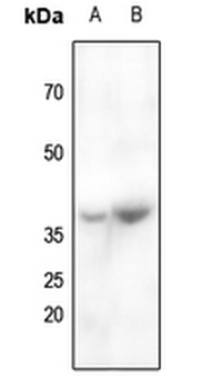 CABP4 Antibody