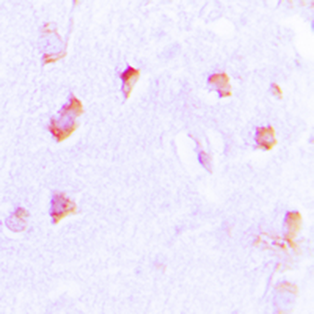 Anti-Collagen 20 alpha 1 Antibody