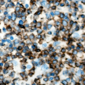 Anti-RELT Antibody