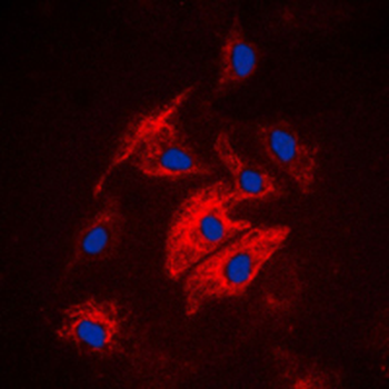 Anti-MAST4 Antibody