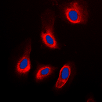 Anti-ADPGK Antibody