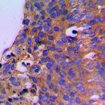 Anti-CEP41 Antibody