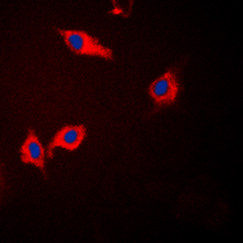 Anti-CK1 alpha Antibody