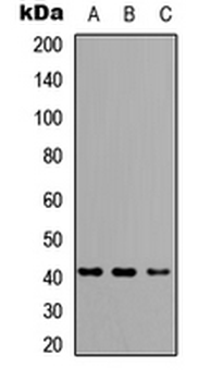 HLA-A/B/C Antibody