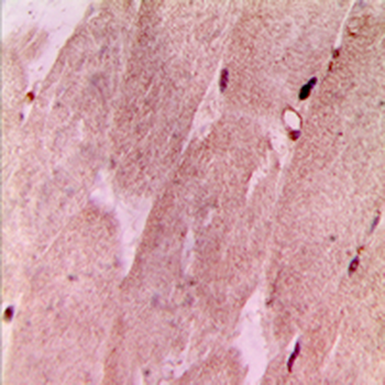 Anti-RPL3L Antibody