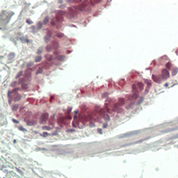 Anti-ZNF496 Antibody