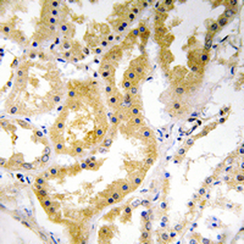 Anti-ABHD4 Antibody