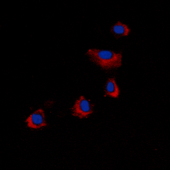 Anti-ARRDC4 Antibody