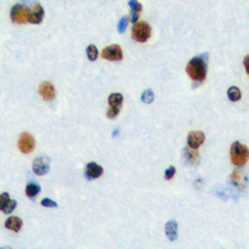 Anti-HEN1/2 Antibody