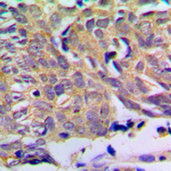 Anti-PXMP2 Antibody