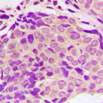 Anti-SH2D4A Antibody