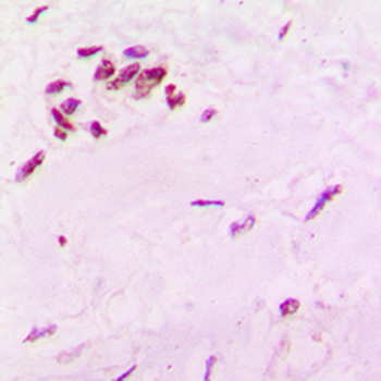 Anti-SOX6 Antibody