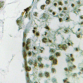 Anti-Ubiquilin 3 Antibody