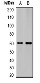 Ephrin B1/2 Antibody