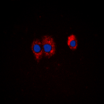 Anti-PI3K p85 alpha/p55 gamma (pY467/199) Antibody
