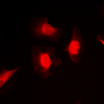 Anti-PKC iota/zeta (pT412/410) Antibody