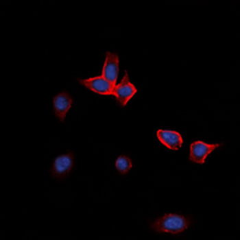 Anti-EPHA2 Antibody