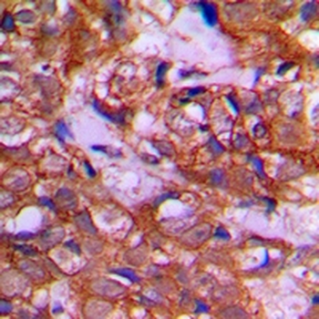 Anti-DZIP3 Antibody
