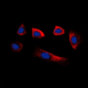 Anti-Glycerate Kinase Antibody