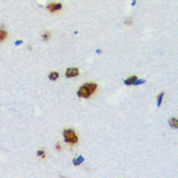 Anti-ZNF668 Antibody