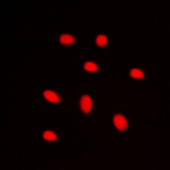 Anti-ZNF668 Antibody