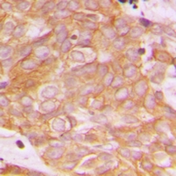 Anti-BEGAIN Antibody