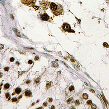 Anti-ASF1B Antibody