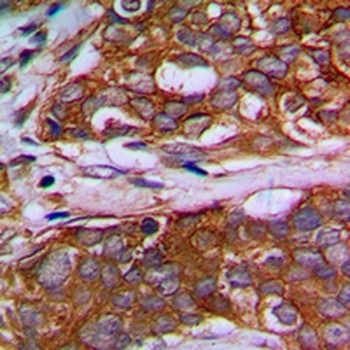 Anti-MRPL22 Antibody