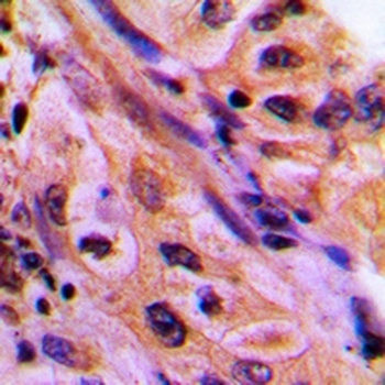 Anti-CDC42EP4 Antibody