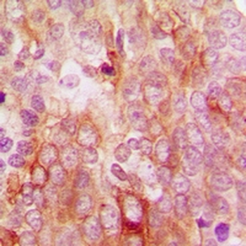 Anti-MCT12 Antibody