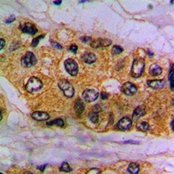 Anti-PKE Antibody