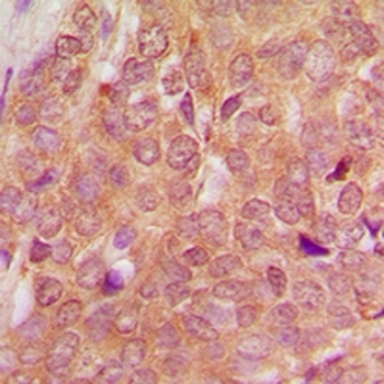 Anti-SEN54 Antibody
