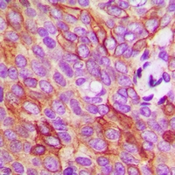 Anti-TMEM16J Antibody