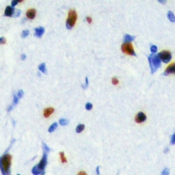 Anti-SRSF5 Antibody
